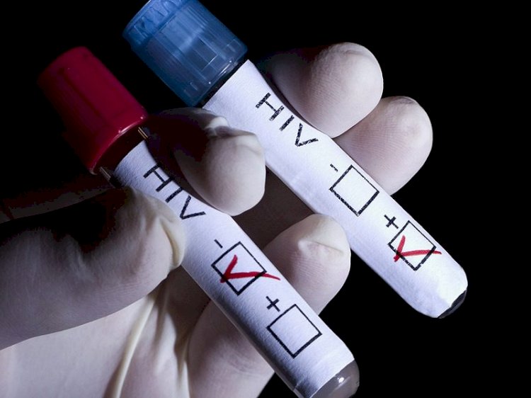 Nova variante do HIV está circulando em pelo menos três estados brasileiros, diz estudo