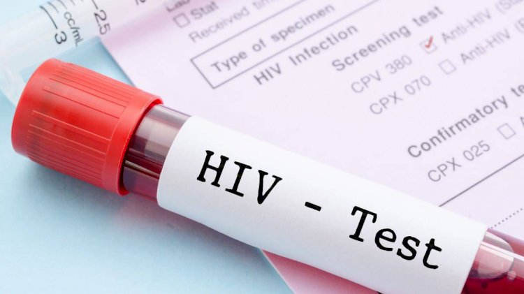 ES registrou 913 novos casos de HIV em 2024